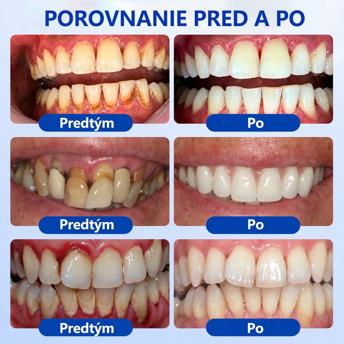 🇸🇰👨‍⚕️✅🦷𝑮𝒍𝒊𝒎𝒎𝒆𝒓𝒍𝒚®🥅🥅𝑮𝒖𝒎𝑹𝒆𝒗𝒊𝒗𝒆 𝑮é𝒍 𝒏𝒂 𝒓𝒆𝒈𝒆𝒏𝒆𝒓á𝒄𝒊𝒖 𝒑𝒂𝒓𝒐𝒅𝒐𝒏𝒕𝒖