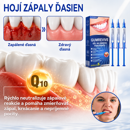 🇸🇰👨‍⚕️✅🦷𝑮𝒍𝒊𝒎𝒎𝒆𝒓𝒍𝒚®🥅🥅𝑮𝒖𝒎𝑹𝒆𝒗𝒊𝒗𝒆 𝑮é𝒍 𝒏𝒂 𝒓𝒆𝒈𝒆𝒏𝒆𝒓á𝒄𝒊𝒖 𝒑𝒂𝒓𝒐𝒅𝒐𝒏𝒕𝒖