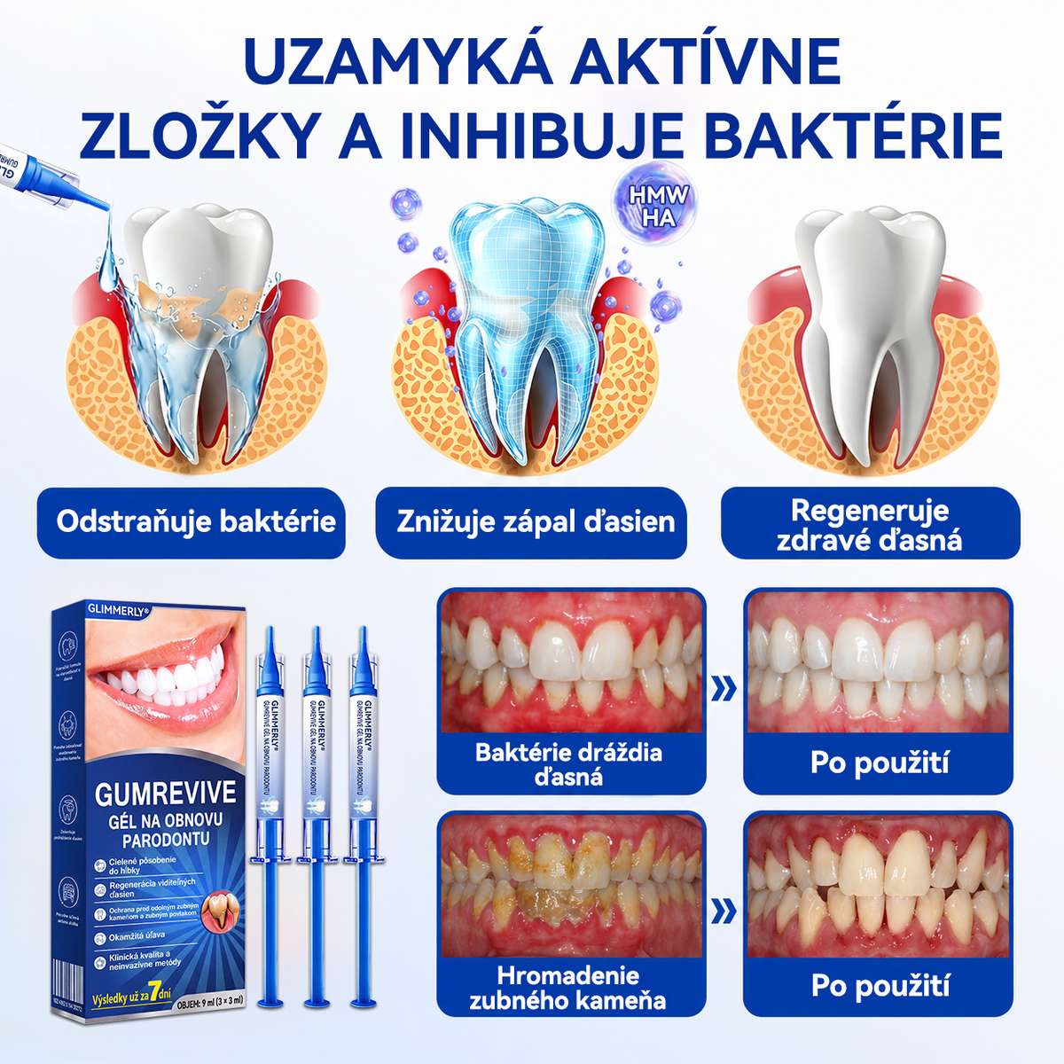 🇸🇰👨‍⚕️✅🦷𝑮𝒍𝒊𝒎𝒎𝒆𝒓𝒍𝒚®🥅🥅𝑮𝒖𝒎𝑹𝒆𝒗𝒊𝒗𝒆 𝑮é𝒍 𝒏𝒂 𝒓𝒆𝒈𝒆𝒏𝒆𝒓á𝒄𝒊𝒖 𝒑𝒂𝒓𝒐𝒅𝒐𝒏𝒕𝒖