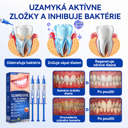 🇸🇰👨‍⚕️✅🦷𝑮𝒍𝒊𝒎𝒎𝒆𝒓𝒍𝒚®🥅🥅𝑮𝒖𝒎𝑹𝒆𝒗𝒊𝒗𝒆 𝑮é𝒍 𝒏𝒂 𝒓𝒆𝒈𝒆𝒏𝒆𝒓á𝒄𝒊𝒖 𝒑𝒂𝒓𝒐𝒅𝒐𝒏𝒕𝒖