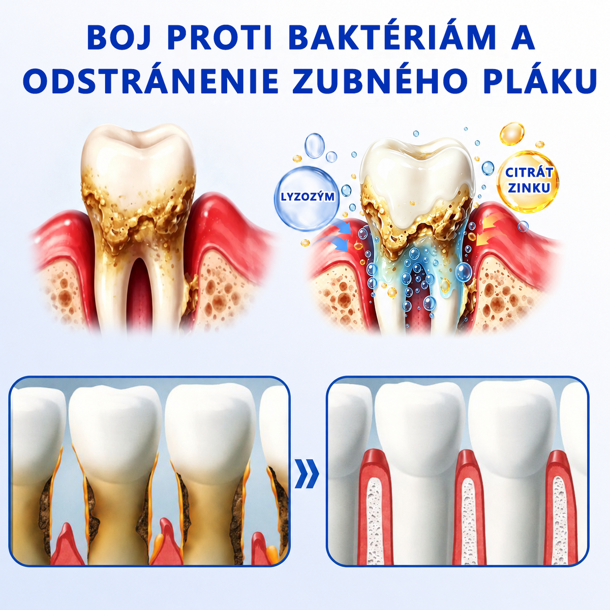 🇸🇰👨‍⚕️✅🦷𝑮𝒍𝒊𝒎𝒎𝒆𝒓𝒍𝒚®🥅🥅𝑮𝒖𝒎𝑹𝒆𝒗𝒊𝒗𝒆 𝑮é𝒍 𝒏𝒂 𝒓𝒆𝒈𝒆𝒏𝒆𝒓á𝒄𝒊𝒖 𝒑𝒂𝒓𝒐𝒅𝒐𝒏𝒕𝒖