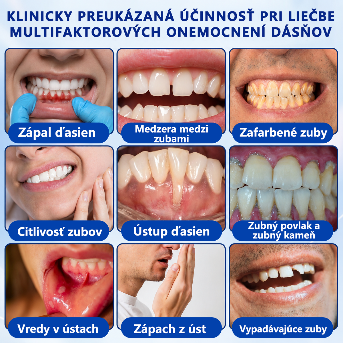 🇸🇰👨‍⚕️✅🦷𝑮𝒍𝒊𝒎𝒎𝒆𝒓𝒍𝒚®🥅🥅𝑮𝒖𝒎𝑹𝒆𝒗𝒊𝒗𝒆 𝑮é𝒍 𝒏𝒂 𝒓𝒆𝒈𝒆𝒏𝒆𝒓á𝒄𝒊𝒖 𝒑𝒂𝒓𝒐𝒅𝒐𝒏𝒕𝒖