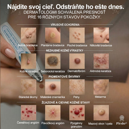 𝐎𝐟𝐢𝐜𝐢𝐚𝐥𝐧𝐲 𝐨𝐛𝐜𝐡𝐨𝐝 𝐦𝐚𝐫𝐤𝐲 |✅️🧶𝐏i𝐜𝐝o® 7dni Prípravok na odstránenie kožných výrastkov a pigmentových škvŕn (bezbolestný roll-on aplikátor bez jaziev)