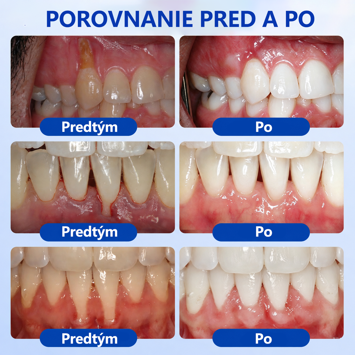 🇸🇰👨‍⚕️✅🦷𝑮𝒍𝒊𝒎𝒎𝒆𝒓𝒍𝒚®🥅🥅𝑮𝒖𝒎𝑹𝒆𝒗𝒊𝒗𝒆 𝑮é𝒍 𝒏𝒂 𝒓𝒆𝒈𝒆𝒏𝒆𝒓á𝒄𝒊𝒖 𝒑𝒂𝒓𝒐𝒅𝒐𝒏𝒕𝒖